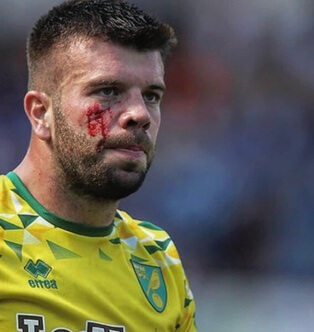 Grant Hanley injured during match  